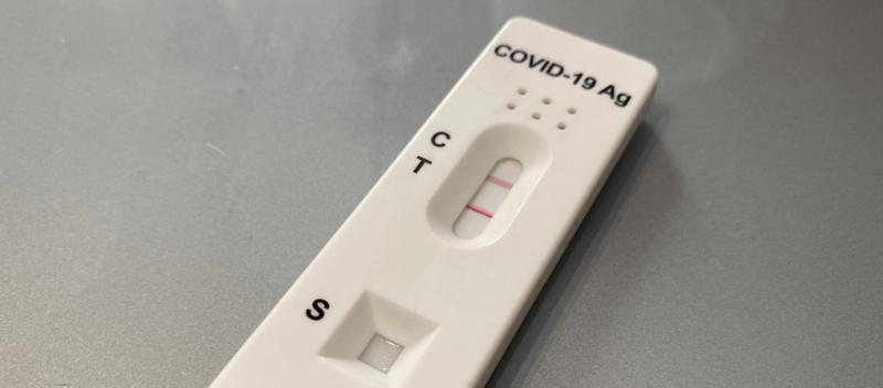 Imagen de archivo de un test de antígenos / TA